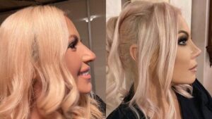 Камелия три месеца преди и три месеца след промяната